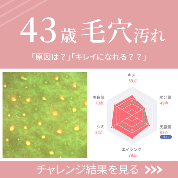 【vol.1】 毛穴汚れ　43歳女性