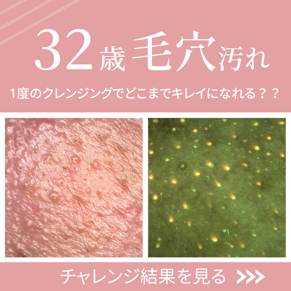【vol.９】１度のクレンジングでどこまでキレイになれる？32歳