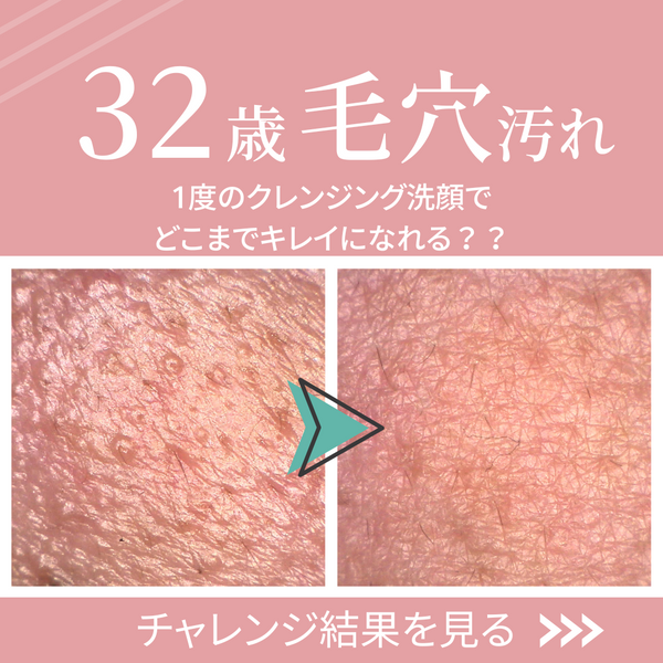 【vol.11】１度のクレンジング＆洗顔でどこまでキレイになれる？32歳